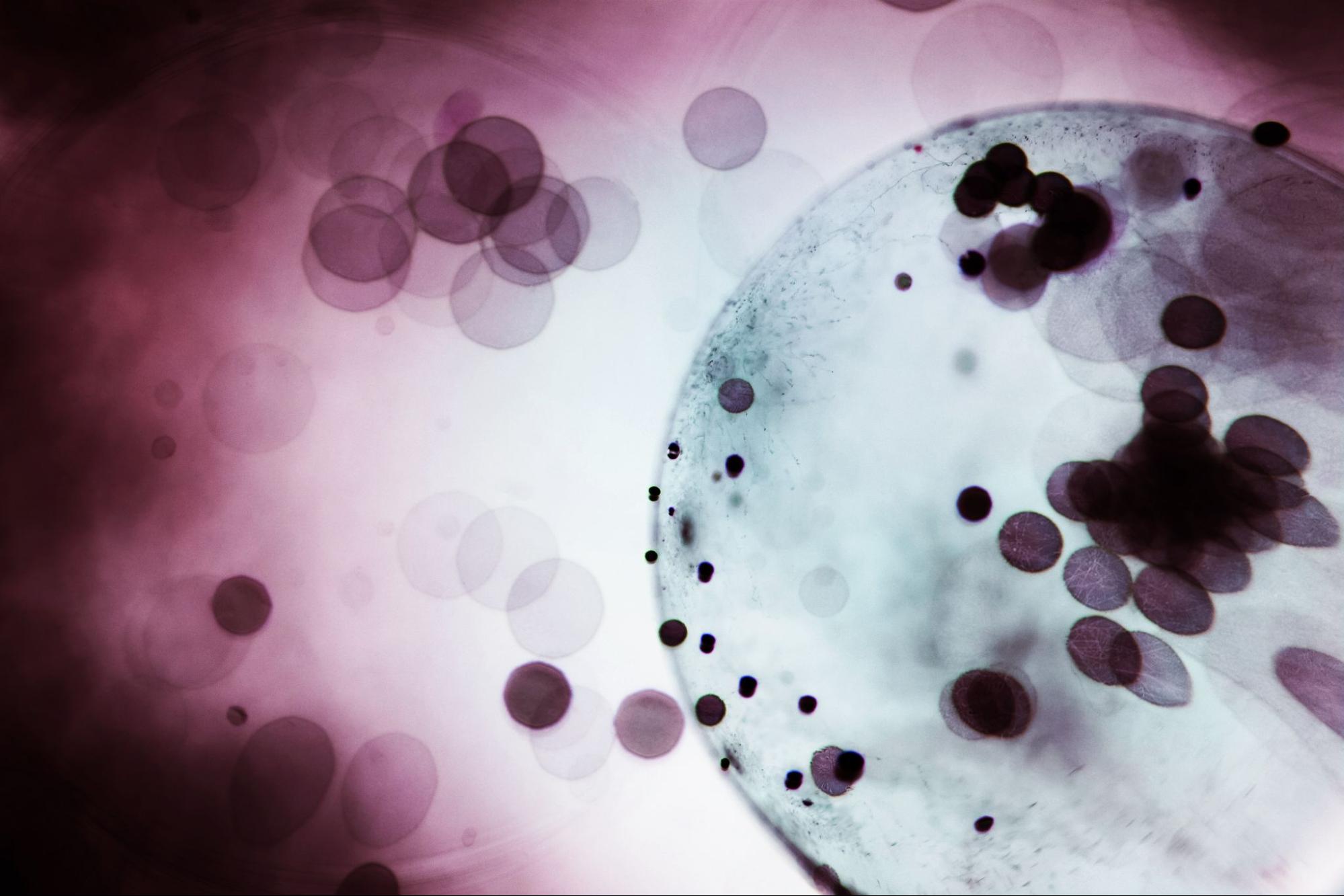 causas hematuria
